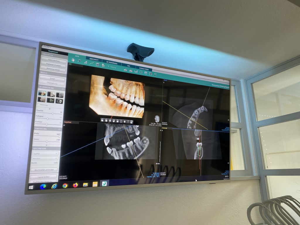 Unverzichtbar für die Oralchirurgie - das 3D Röntgen